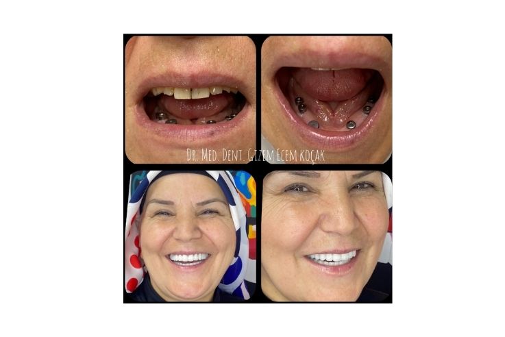 Dr. Gizem Ecem Koçak Estetik ve Cerrahi Diş Kliniği