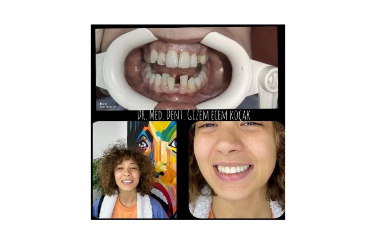 Dr. Gizem Ecem Koçak Estetik ve Cerrahi Diş Kliniği