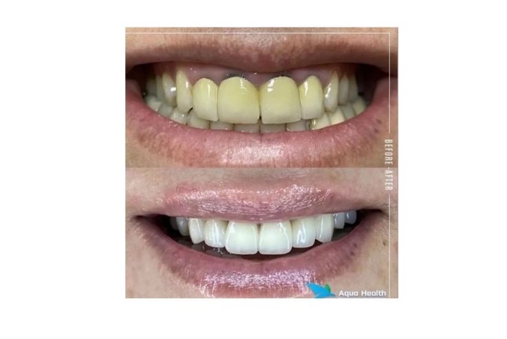 Dr. Gizem Ecem Koçak Estetik ve Cerrahi Diş Kliniği