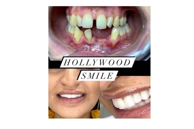 Dr. Gizem Ecem Koçak Estetik ve Cerrahi Diş Kliniği