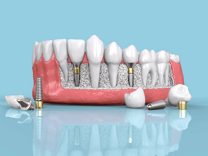 Bakırköy Dental Plus Diş Kliniği
