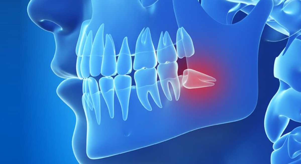 Bakırköy Dental Plus Diş Kliniği